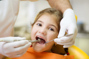 teeth cleaning east orange